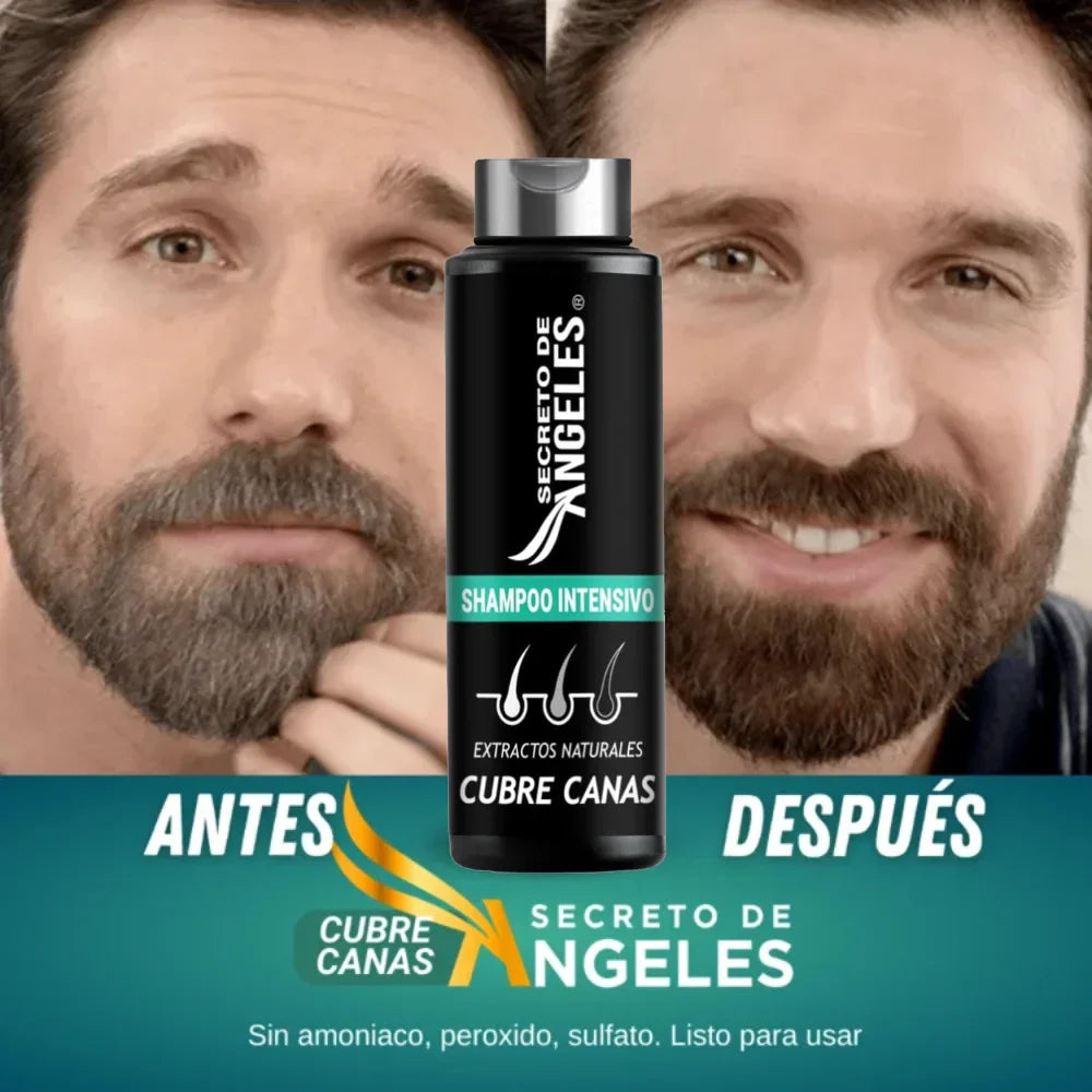 SUPER OFERA LIMITADA 🔥SHAMPOO CUBRECANAS + SPLAS CAPILAR RESVE HOMBRES Y MUJERES